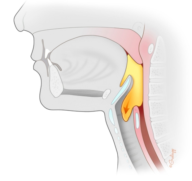 AI-Powered Toolkit for Automated Swallowing Kinematic Analysis in X-Ray Videofluoroscopy